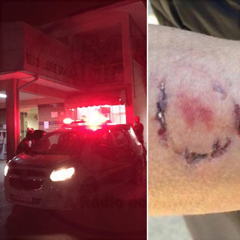 Vampiro? – ALTERADO, HOMEM ATACA POLICIAIS A MORDIDAS, RASGA FARDA, FERE E É DETIDO