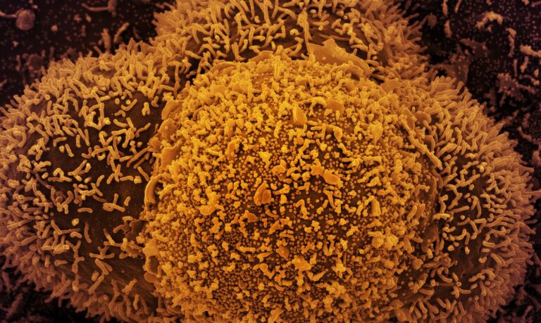 NOVA LINHAGEM BA.2 DA ÔMICRON É IDENTIFICADA NO RIO DE JANEIRO E SANTA CATARINA; mais contagiosa
