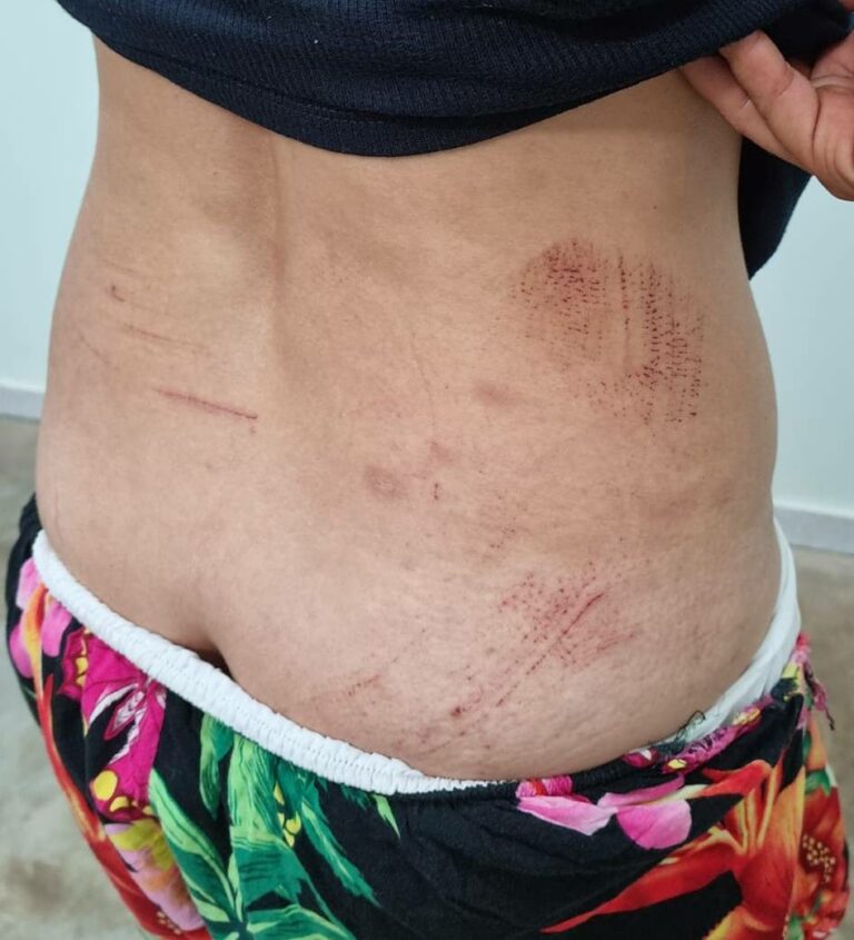 Homem é preso ao ser flagrado agredindo ex-companheira no meio da rua