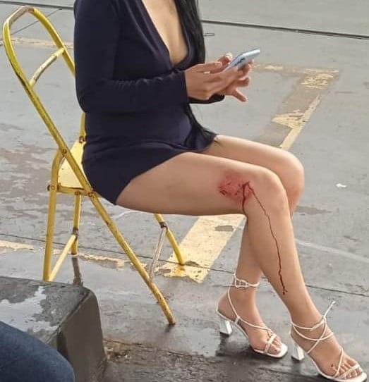 DDM-garota ferida