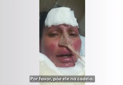 Ao voltar do coma, mulher grava vídeo e acusa marido de atear fogo nela